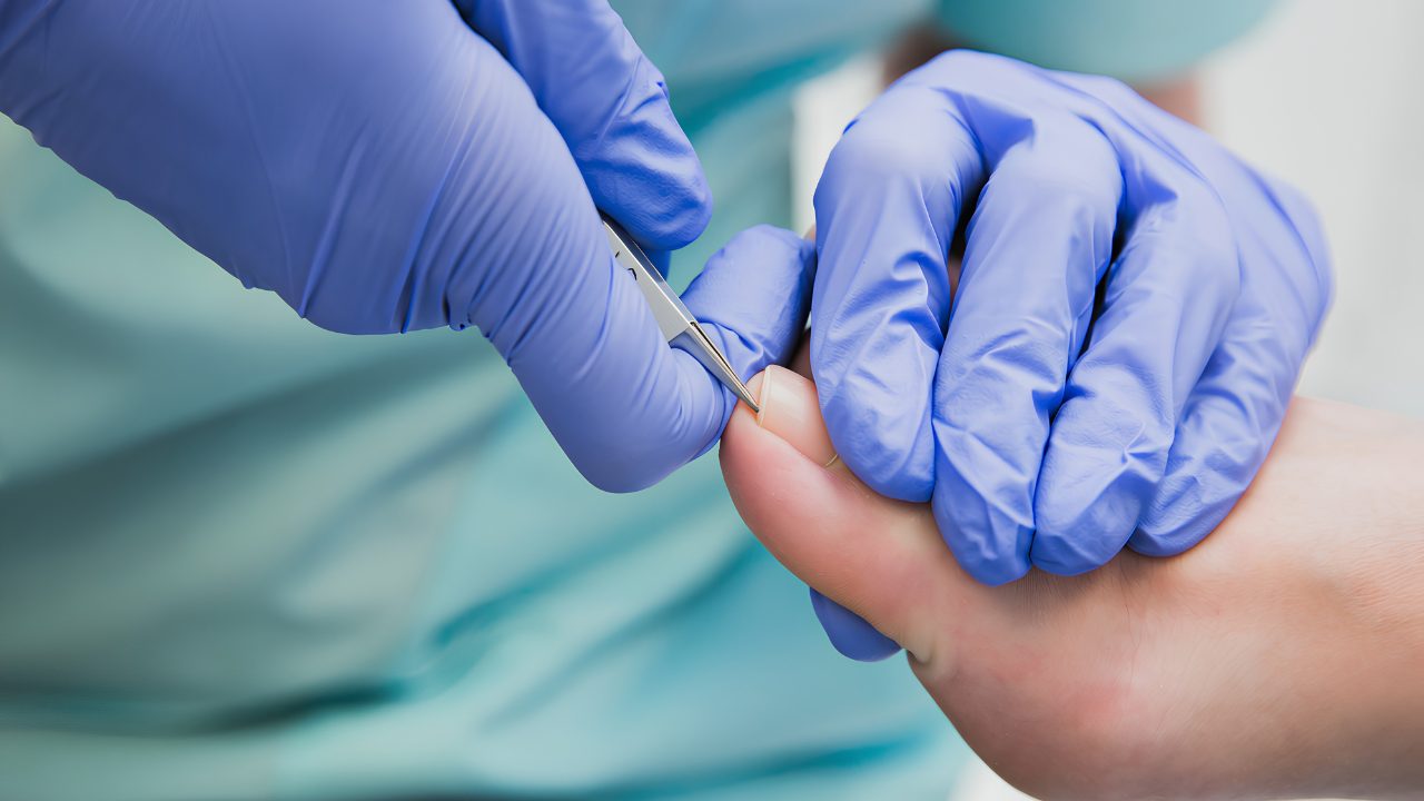 Podiatrist examining a patient's toe for an ingrown toenail
